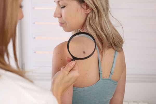 What Are Traditional Skin Lesion Removal Methods Matlock?