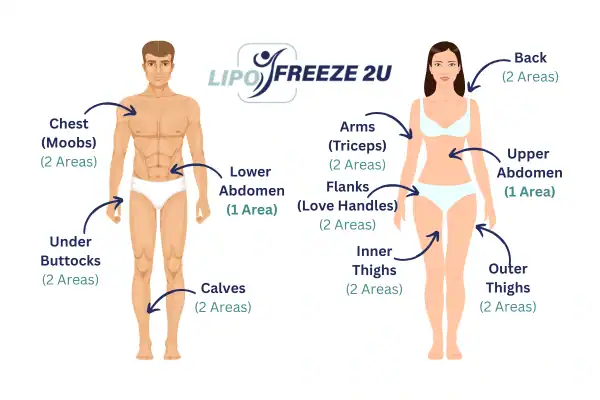 Areas you can have fat freezing treatment Matlock