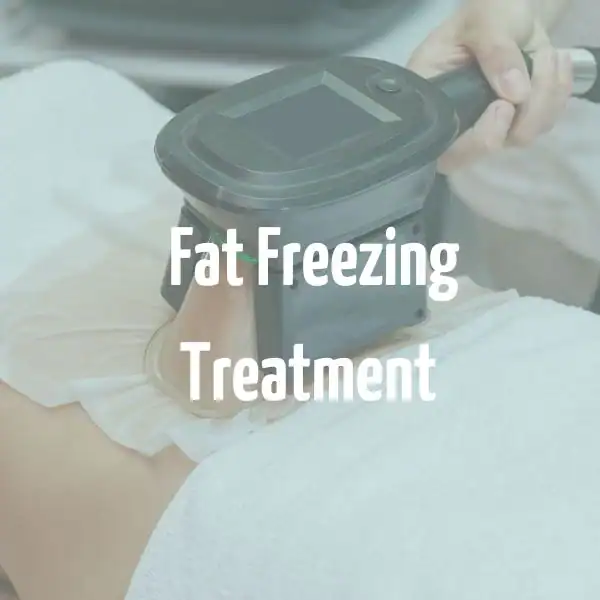fat freezing treatment Matlock
