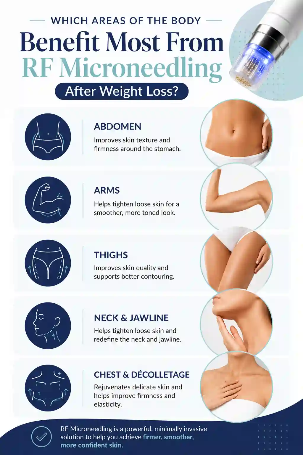 Which Areas of the Body Benefit Most From RF Microneedling After Weight Loss Matlock
